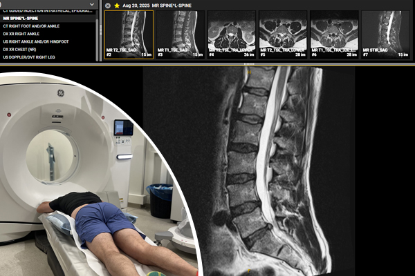 Tim Keeley, Principal Physiotherapist and creator of the Lumbar Spine Disc Injury Rehab Program